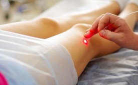 Acupuntura a Laser